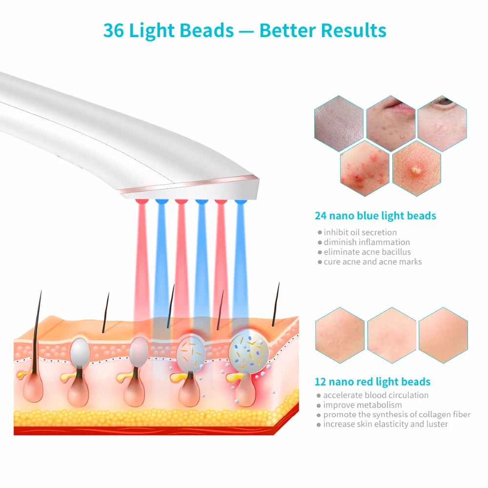 Acne Light Therapy Xpreen Wireless Rechargeable Light Acne Treatment Device Acne Clearing Eraser with Blue Light and Red Light - photo 9