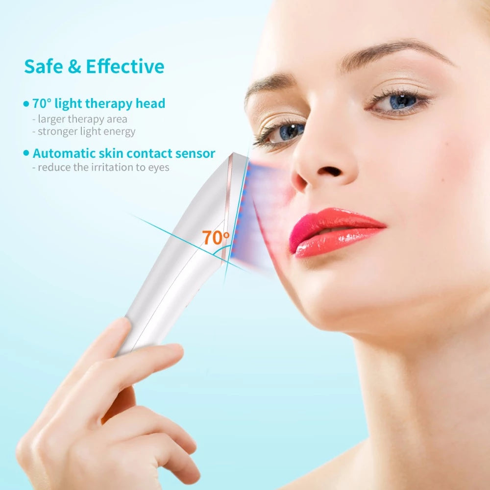 Acne Light Therapy Xpreen Wireless Rechargeable Light Acne Treatment Device Acne Clearing Eraser with Blue Light and Red Light - photo 10